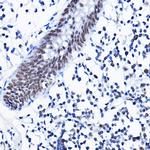 HDAC1 Antibody in Immunohistochemistry (Paraffin) (IHC (P))