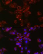 APOE Antibody in Immunocytochemistry (ICC/IF)