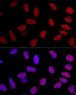 Ku70 Antibody in Immunocytochemistry (ICC/IF)