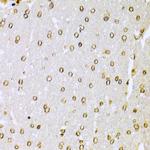 Ku70 Antibody in Immunohistochemistry (Paraffin) (IHC (P))