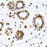 Ku70 Antibody in Immunohistochemistry (Paraffin) (IHC (P))