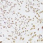 Ku70 Antibody in Immunohistochemistry (Paraffin) (IHC (P))