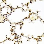 Ku70 Antibody in Immunohistochemistry (Paraffin) (IHC (P))