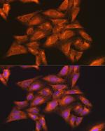 IKK gamma Antibody in Immunocytochemistry (ICC/IF)