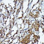 JAK2 Antibody in Immunohistochemistry (Paraffin) (IHC (P))