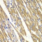 Tyrosinase Antibody in Immunohistochemistry (Paraffin) (IHC (P))