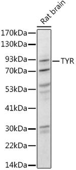 Tyrosinase Antibody in Western Blot (WB)