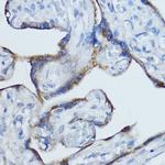 Aromatase Antibody in Immunohistochemistry (Paraffin) (IHC (P))