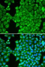 Carbonic Anhydrase III Antibody in Immunocytochemistry (ICC/IF)