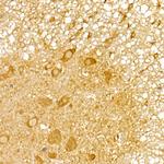 TRIM21 Antibody in Immunohistochemistry (Paraffin) (IHC (P))