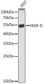 VEGFD Antibody in Western Blot (WB)