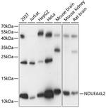 NDUFA4L2 Antibody in Western Blot (WB)