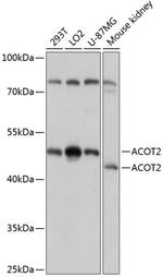ACOT2 Antibody in Western Blot (WB)