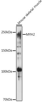 MYH2 Antibody in Western Blot (WB)
