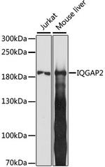 IQGAP2 Antibody in Western Blot (WB)