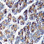 PLEKHB2 Antibody in Immunohistochemistry (Paraffin) (IHC (P))