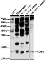 ACYP2 Antibody in Western Blot (WB)