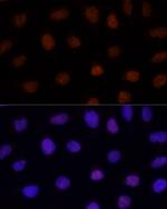 GLI2 Antibody in Immunocytochemistry (ICC/IF)