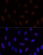 GLI2 Antibody in Immunocytochemistry (ICC/IF)