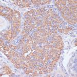 PIK3R2 Antibody in Immunohistochemistry (Paraffin) (IHC (P))