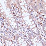 PIK3R2 Antibody in Immunohistochemistry (Paraffin) (IHC (P))