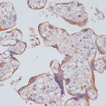 PIK3R2 Antibody in Immunohistochemistry (Paraffin) (IHC (P))