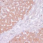 PIK3R2 Antibody in Immunohistochemistry (Paraffin) (IHC (P))