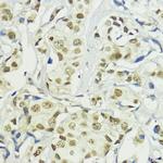 BAZ2A Antibody in Immunohistochemistry (Paraffin) (IHC (P))