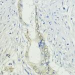 BAZ2A Antibody in Immunohistochemistry (Paraffin) (IHC (P))