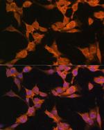 CaMKII alpha Antibody in Immunocytochemistry (ICC/IF)