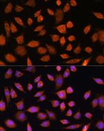 PLD3 Antibody in Immunocytochemistry (ICC/IF)