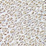 RSK1/RSK2/RSK3 Antibody in Immunohistochemistry (Paraffin) (IHC (P))