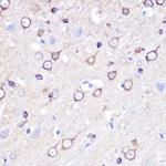 Stathmin 1 Antibody in Immunohistochemistry (Paraffin) (IHC (P))