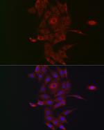 Neuropilin 2 Antibody in Immunocytochemistry (ICC/IF)