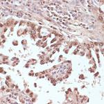 RAD50 Antibody in Immunohistochemistry (Paraffin) (IHC (P))