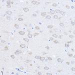 UBE4A Antibody in Immunohistochemistry (Paraffin) (IHC (P))