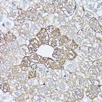 Glutamine Synthetase Antibody in Immunohistochemistry (Paraffin) (IHC (P))