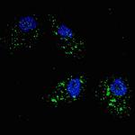 SQSTM1 Antibody in Immunocytochemistry (ICC/IF)