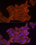 TK1 Antibody in Immunocytochemistry (ICC/IF)