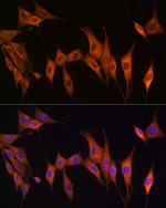 TK1 Antibody in Immunocytochemistry (ICC/IF)