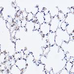 DDX3 Antibody in Immunohistochemistry (Paraffin) (IHC (P))