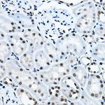 MYST2 Antibody in Immunohistochemistry (Paraffin) (IHC (P))