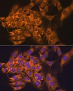 RPL17 Antibody in Immunocytochemistry (ICC/IF)