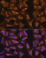 RPL17 Antibody in Immunocytochemistry (ICC/IF)