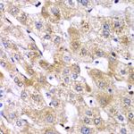 RPS10 Antibody in Immunohistochemistry (Paraffin) (IHC (P))