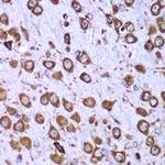 RPS10 Antibody in Immunohistochemistry (Paraffin) (IHC (P))