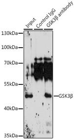 GSK3B Antibody in Immunoprecipitation (IP)