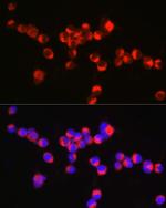 Synaptophysin Antibody in Immunocytochemistry (ICC/IF)