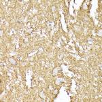 Synaptophysin Antibody in Immunohistochemistry (Paraffin) (IHC (P))