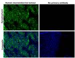 Synaptophysin Antibody in Immunohistochemistry (Paraffin) (IHC (P))